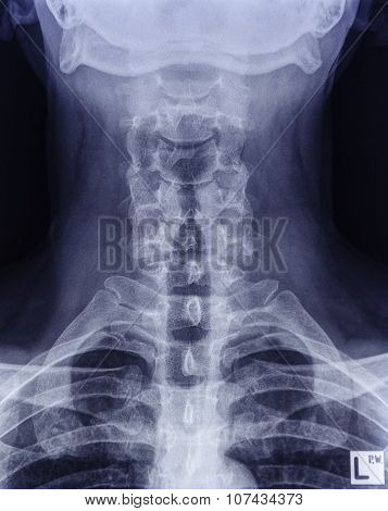 Neck X-ray