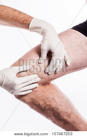 Doctor In Medical Gloves Examines A Person With Varicose Veins Of The Lower Extremities And Venous T