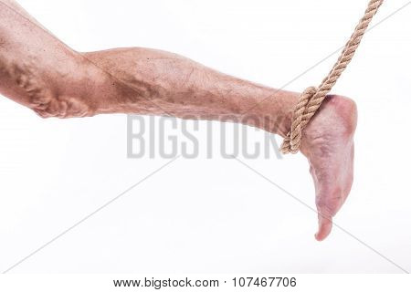 Rope Holding Human Leg Ailing Varicose Veins Of The Lower Extremities And Venous Thrombophlebitis An