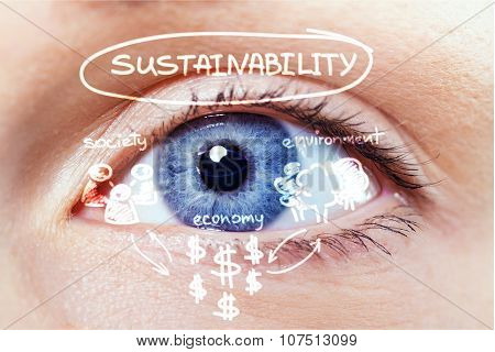 Cataract.
