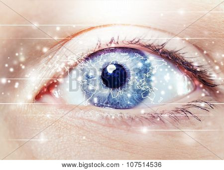 Cataract.
