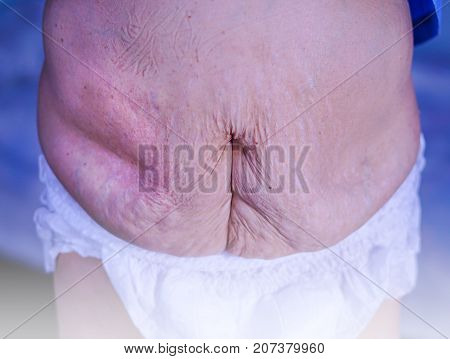 Belly older women 80 years old looks wrinkled, through childbirth, then 3.
