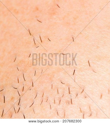 bristles on the skin. close-up . Photo of abstract background