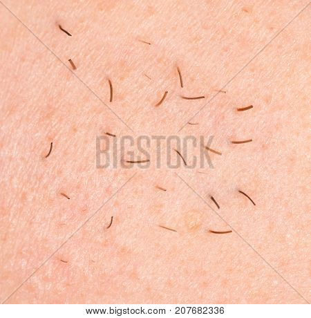 bristles on the skin. close-up . Photo of abstract background