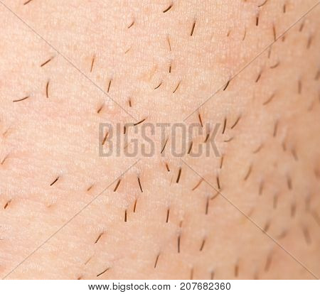 bristles on the skin. close-up . Photo of abstract background