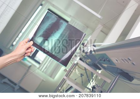 Doctor examines R-control film of patient's lung.