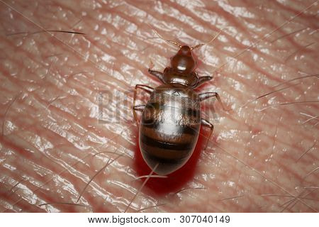 3d rendered medically accurate illustration of a bed bug on human skin