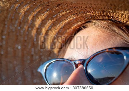 Forehead Of A Woman With Freckles In Direct Sunlight, Close-up View. Uv Protection, Sun Radiation Co