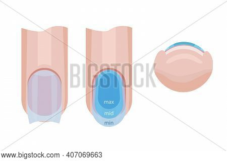 Nail Care. Distribution Of The Base On The Nail. Illustration For A Manual For Manicure. Vector
