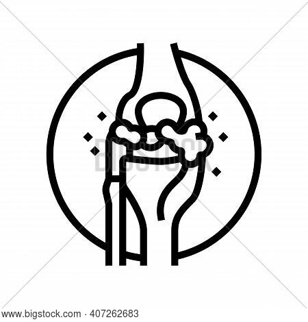 Lumps Around Joints Line Icon Vector. Lumps Around Joints Sign. Isolated Contour Symbol Black Illust