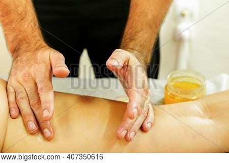 Beautiful Young Woman In Spa Salon Having Anti Cellulite Massage Therapy With Honey For Fat Burning.
