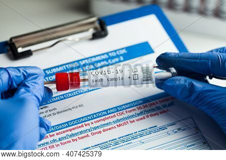 Rt-pcr Covid-19 Virus Disease Diagnostic Test,lab Technician Wearing Blue Protective Gloves Holding 