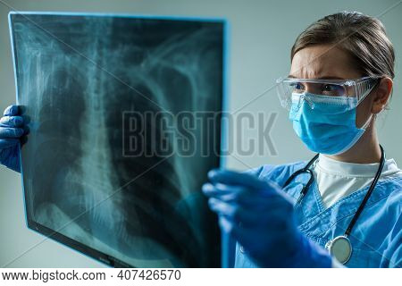 Female Gp Doctor Holding Chest X-ray Film Scan,medical Woman Worker Examining Patient Lungs During C