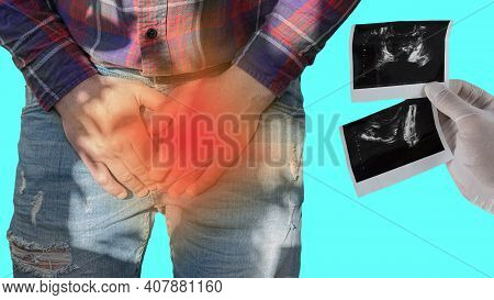 Medical Banner Of Urology,pain In The Genitourinary System In A Man, Ultrasound Of The Prostate Glan