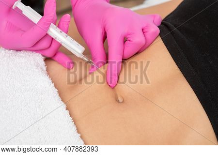 A Doctor Of Aesthetic Cosmetology Makes Lipolytic Injections To Burn Body Fat On A Woman’s Stomach A