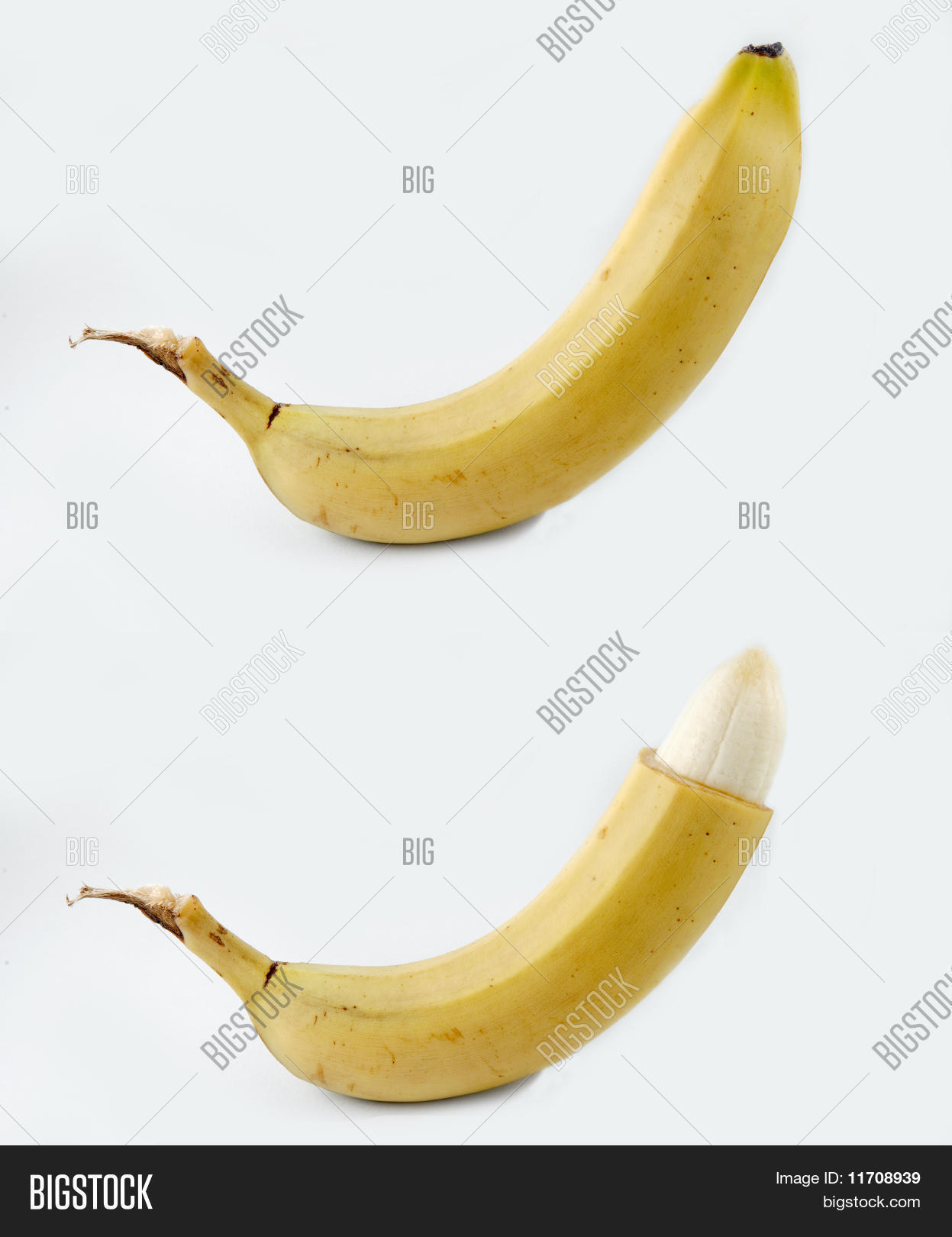 PENIS BEFORE AND AFTER CIRCUMCISION visual data 5