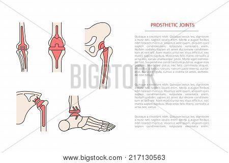 Acetabulum Images Illustrations Vectors Free Bigstock
