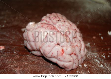 Cerebros