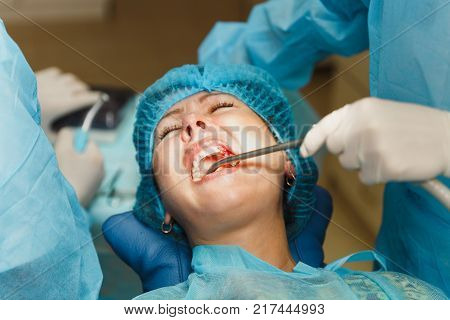 Close Up Process Of Male Professional Dentist Surgeon Performing Operation Install Dental Implant Te