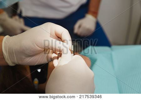 Process Of Preparing And Installing Dental Ceramic Crown. Male Professional Dentist And Female Assis