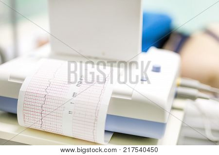 Young happy woman lying on a bed in a hospital while doctor setting a cardiotocography sensor to examine  fetus heartbeat.