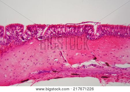 Microscope Photo Of An Ant