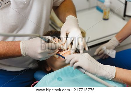 Process Of Preparing And Installing Dental Ceramic Crown. Male Professional Dentist And Female Assis