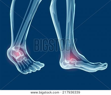 Human leg bones and joints, x-rays. Mecial vector illustration.