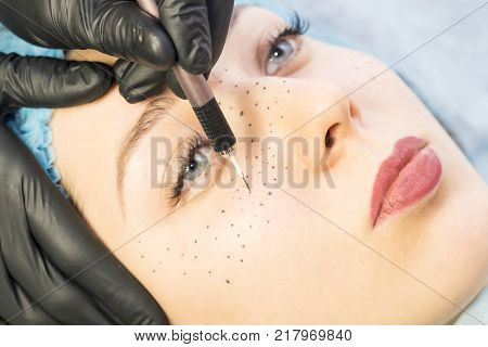 Permanent microblasting tattooing freckles to a woman in a beauty salon