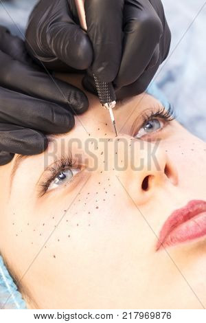 Permanent microblasting tattooing freckles to a woman in a beauty salon