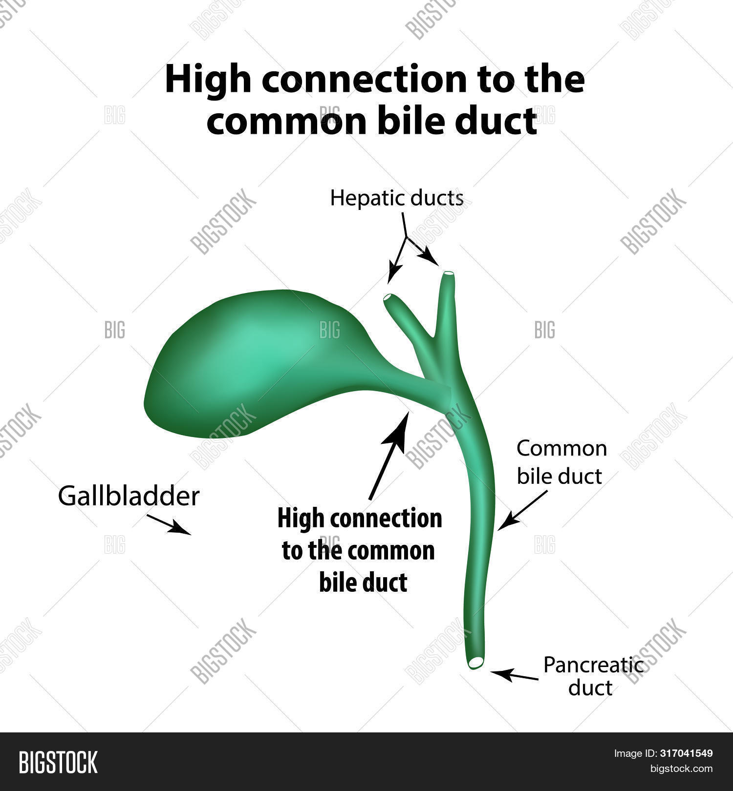 High Connection Common Image & Photo (Free Trial) | Bigstock