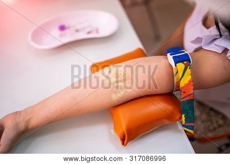 Vein Scanning. Patient Hand With Veins Mapping Close Up
