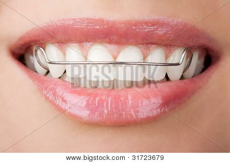 ด้วยระยะเวลาใน