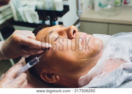 Close-up Of Procedure For Face Lifting Pdo Suture Operation, Face Lifting Surgery. Innovative Techni