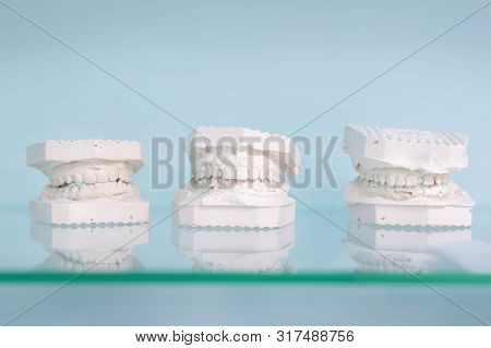 Different Gypsum Human Jews Model On Glass Shelf At Dentist Office On Light Blue Background. Dentist