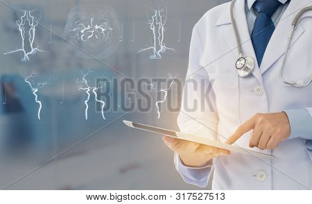 Medical Technology And Medical Research Concept. Doctor Using Digital Tablet With Stroke Brain Resea