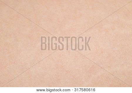Macro Of Human Skin. Human Skin Texture Background