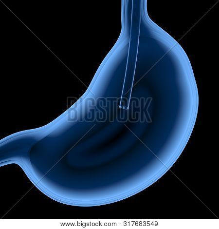 3d Rendering X-ray Endoscope In Stomach Isolated On Black