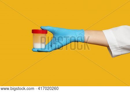 Scientist Holding Container With Sperm On Yellow Background, Closeup