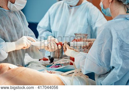 Cosmetic Liposuction Surgery In Actual Operating Room Setting Showing Surgeons Group During Operatio