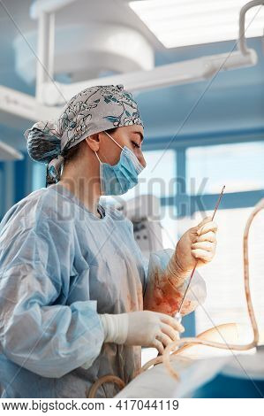 Cosmetic Liposuction Surgery In Actual Operating Room Setting Showing Surgeons Group During Operatio