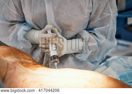 Cosmetic Liposuction Surgery In Actual Operating Room Setting Showing Surgeons Group During Operatio