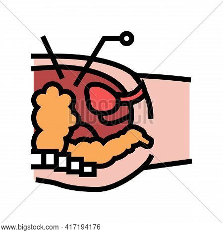 Operation Process Bariatric Color Icon Vector. Operation Process Bariatric Sign. Isolated Symbol Ill