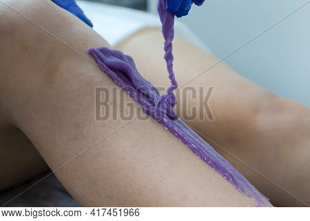 Macro Shot Of Beautician Hand With Twirled Depilation Wax Used For Sugaring Proceedure On Female Leg