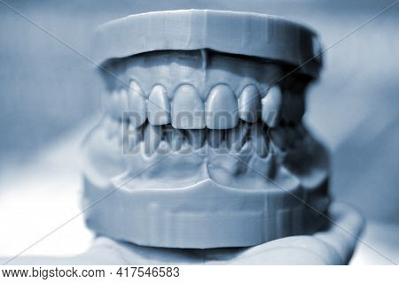 Upper And Lower Jaw Of A Man Printed On A 3d Printer Of Photopolymer.
