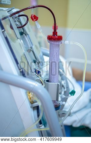 Dialysis Machine Is Working. Acting As A Substitute For The Kidneys To Drive Waste From The Body.