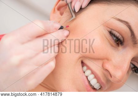 Woman On Electro-epilation Of The Face. Hardware Permanent Removal Of Unwanted Hair In The Salon