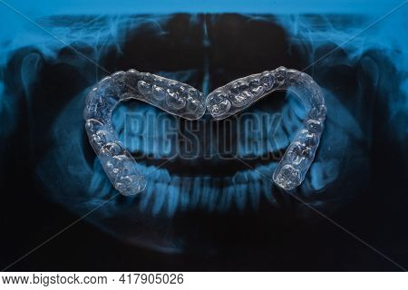 Transparent Bite Correction Trays And X-ray Of The Jaw. Orthodontist Equipment