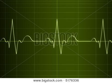 Cardiogram