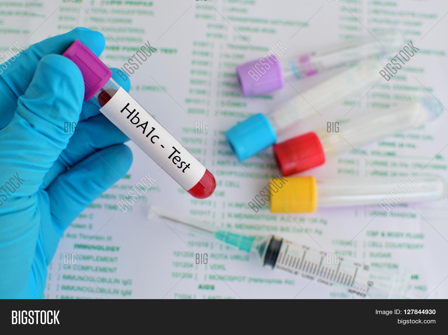Test Tube Blood Sample Image & Photo (Free Trial) Bigstock